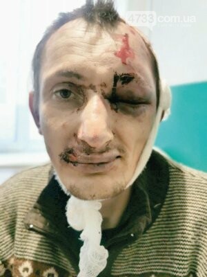 Смілянина відвезли у ліс і катували, на поміч не зупинялась..., фото-1 Смілянина відвезли у ліс і катували, на поміч не зупинялась жодна машина, фото-1